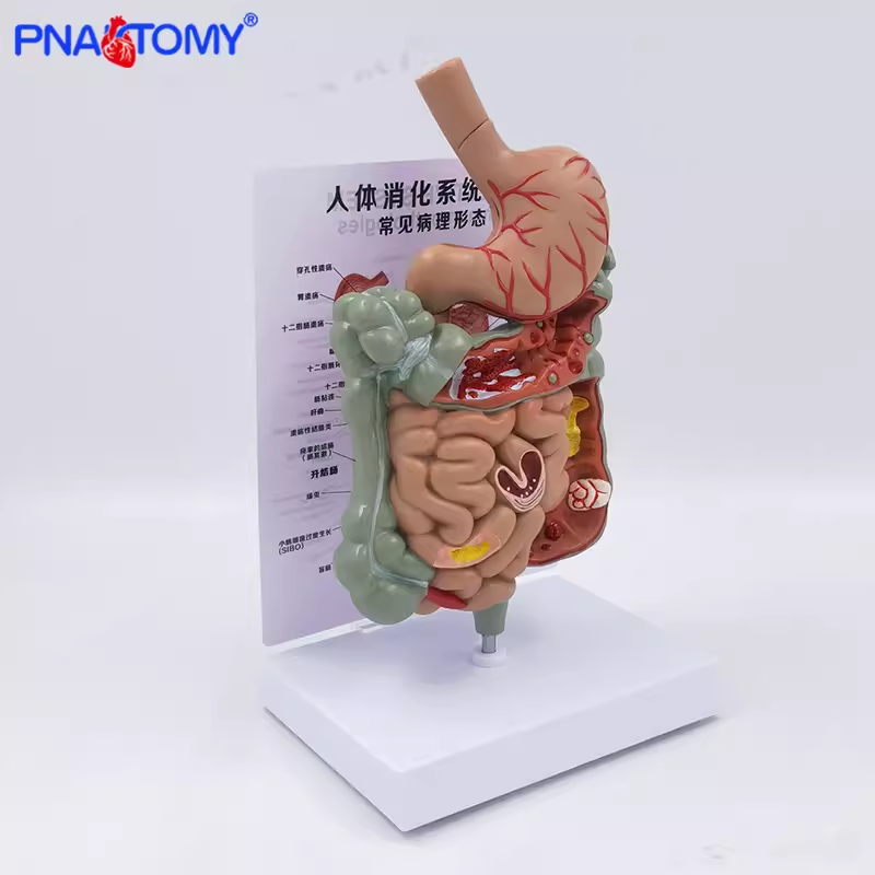 病理消化系统模型胃剖面大肠小肠解剖模型 医学展示教学讲解科普