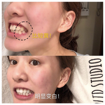 Little red book with the same model buy 2 get 1 ~ teeth white clean calculus dirt smoke stains wash teeth to yellow beauty tooth artifact