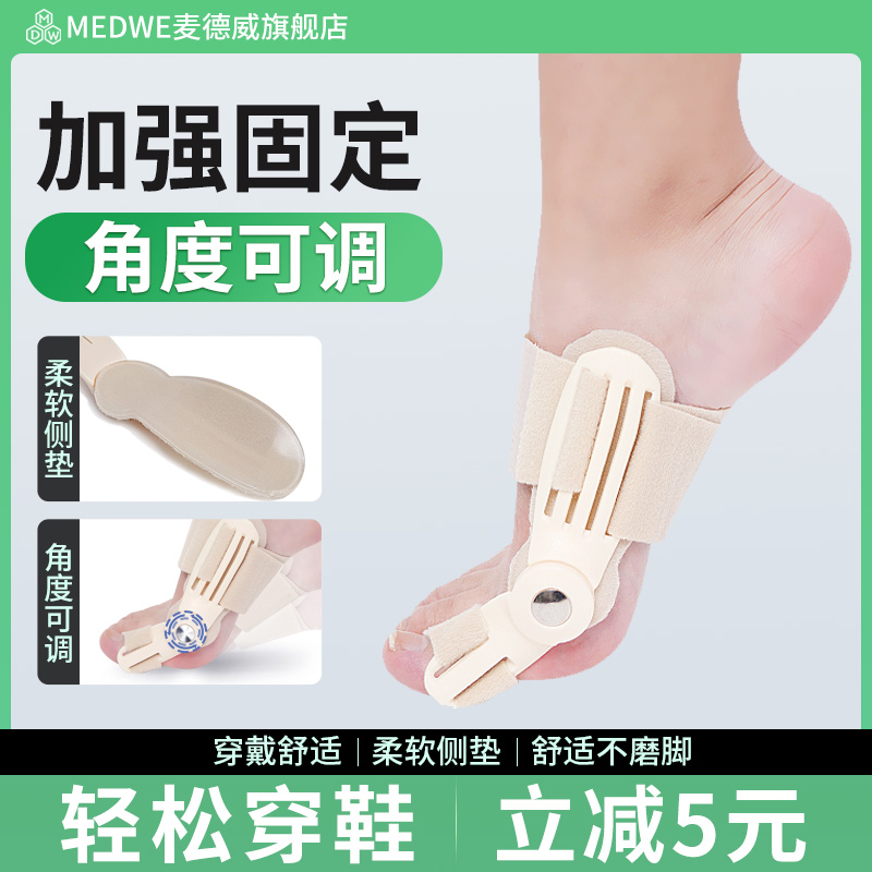 Ms. Medwey's foot thumb bone - tipped toe fixer lady can wear shoes