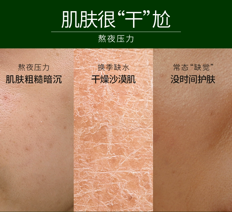 Trehalose triệt để ngủ ngon mặt nạ ngủ nữ dùng một lần hyaluronic axit hydrating bôi nhọ màng bùn thu nhỏ lỗ chân lông - Mặt nạ