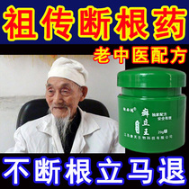 Cowhide antipruritic skin topical treatment of psoriasis fungal infection itching psoriasis head Moss special effect ringworm ointment