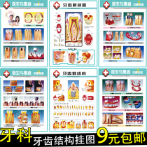 Dental posters wall chart poster picture Hospital Stomatology clinic outpatient oral knowledge poster stickers decorative painting