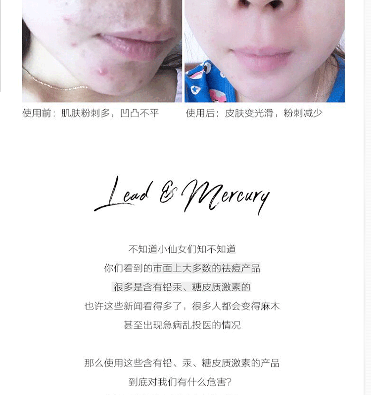 Wen Bao làm đẹp trang điểm Xiaoxi với cùng một đoạn Avigers làm đẹp dưỡng ẩm tinh chất trị mụn mụn trứng cá mờ dần kiểm soát dầu in - Huyết thanh mặt tinh chất peptide