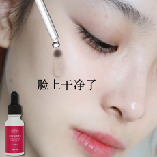 Пропаривание сумка 【小红书推荐】去脸上黑点斑点 玫瑰净颜精油 买3送2 买5送5