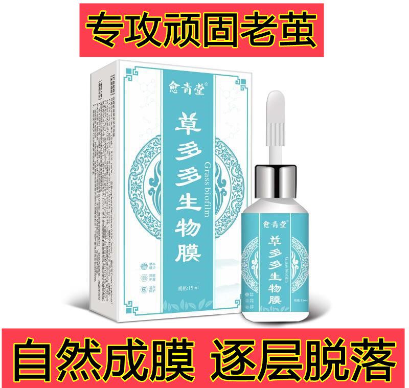 Remove the old cocoon Cocoon Removal Cream to Sole Thick Cocoon Corpus Callus Foot foot Foot Joint Cocoon Dead Skin Softener God