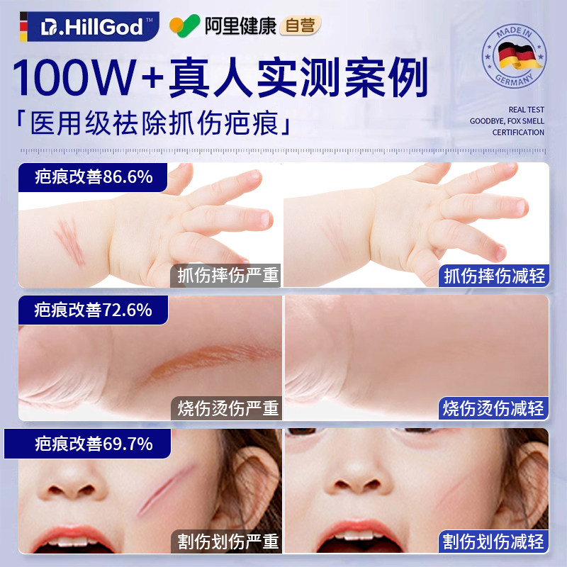 指甲抓伤留疤？2025新型儿童专用祛疤膏真的有效吗？