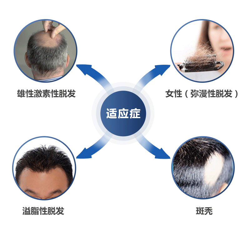 国药准字OTC 蔓迪 米诺地尔酊溶液 防脱生发喷剂 60ml 图3