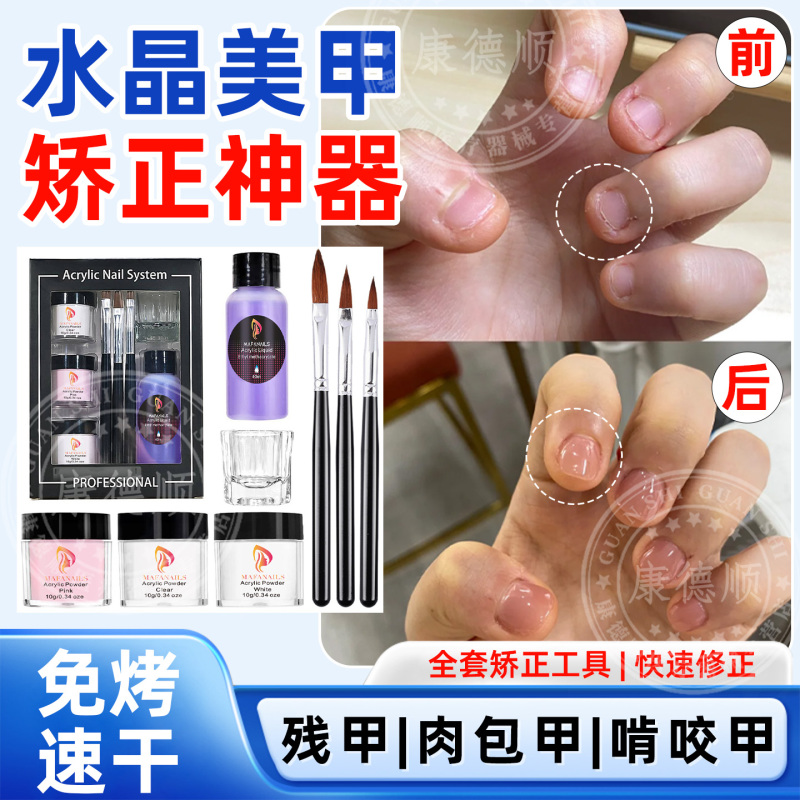 Crystal Nail Correction Kit for Ingrown Toenails, Toenail Material, Crystal Powder, Complete Tool Set for Nail Extension Ll