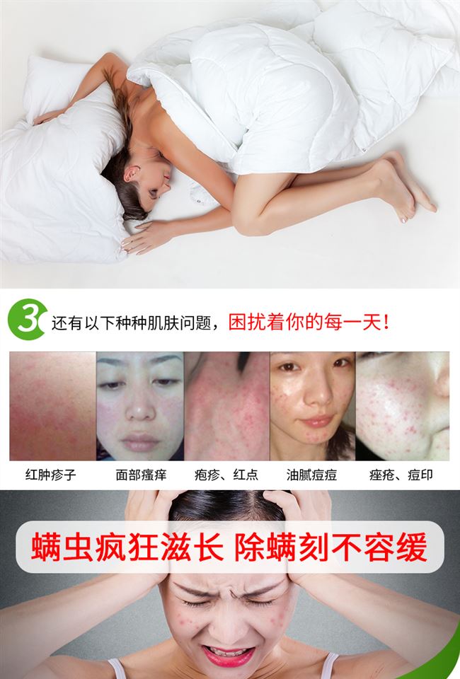 Túi thảm tự nhiên để cào cào cung cấp thuốc chống giun sao dán chống côn trùng hộ gia đình ngoài gián bình xịt raid