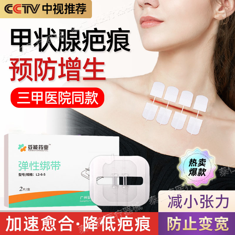 甲状腺减张器术后伤口愈合疤痕增生皮肤减张贴拉链式创口贴医用cl