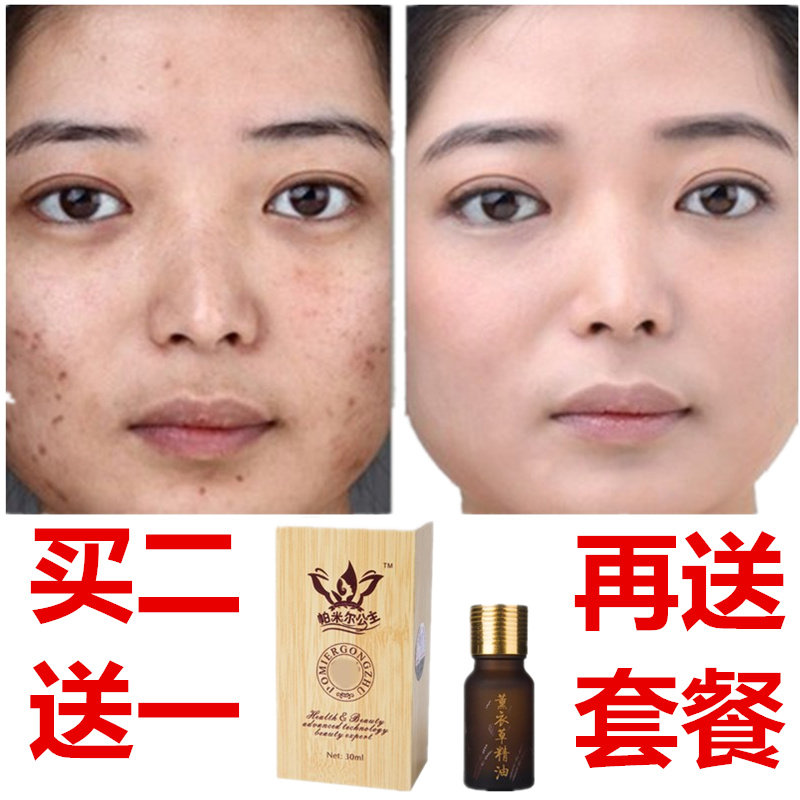 薰衣草精油正品单方脸部祛痘去痘印疤痕帮助睡眠香薰抗敏按摩30ml