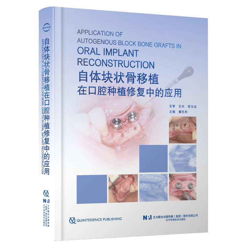 [in Stock] Application of Autologous Block Bone Grafting in Oral Implant Restoration