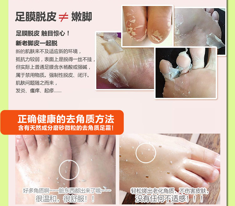 诗 Kem tẩy da chết tẩy tế bào chết tẩy tế bào chết cho chân của ông già Mặt nạ chân chống khô kem got chan
