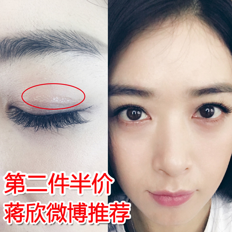 蕾丝双眼皮贴隐形肉色无痕自然防过敏防水网状仙女贴神器透气持久