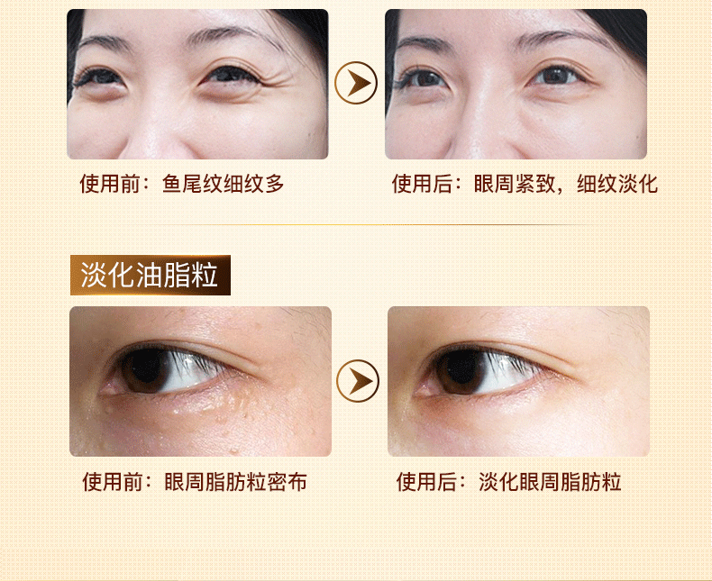 Jinsi Yuxi Vàng Chăm Sóc Mắt Cơ Bắp Lỏng Kem Mắt Nâng Làm Săn Chắc Khử Mùi Mắt Mắt Túi Đôi Mắt Đen kem chống nhăn
