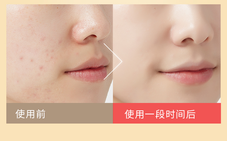 Golden Silk Jade Exfoliating Gel làm sạch sâu cho nam giới và toàn thân phụ nữ muối bò tẩy tế bào chết