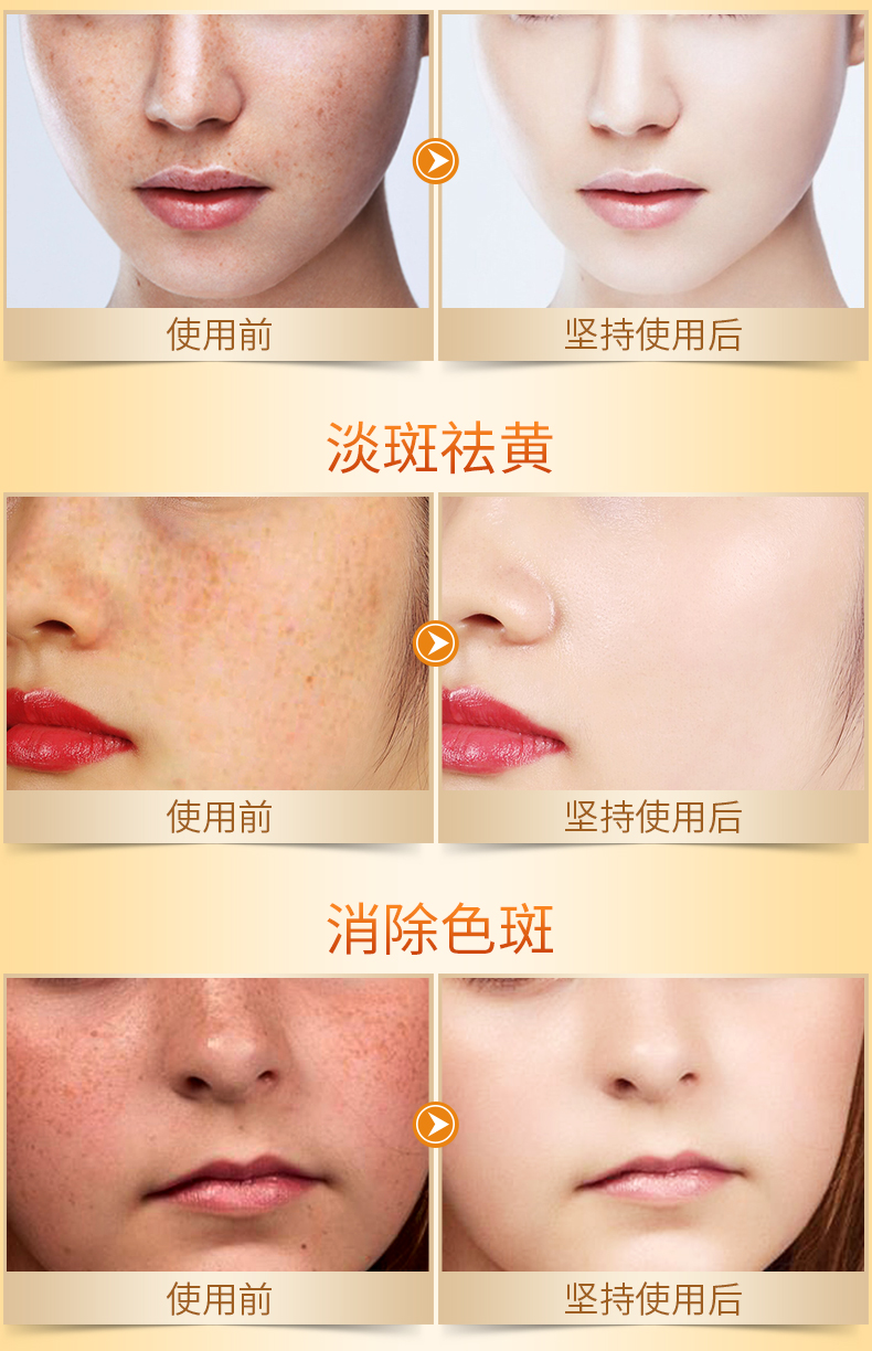 Golden Silk Jade Whitening Spot Corrector 30 Viên nang Hydrating Brightening Skin Điểm đến Vàng Thu hẹp lỗ chân lông serum hoa hồng