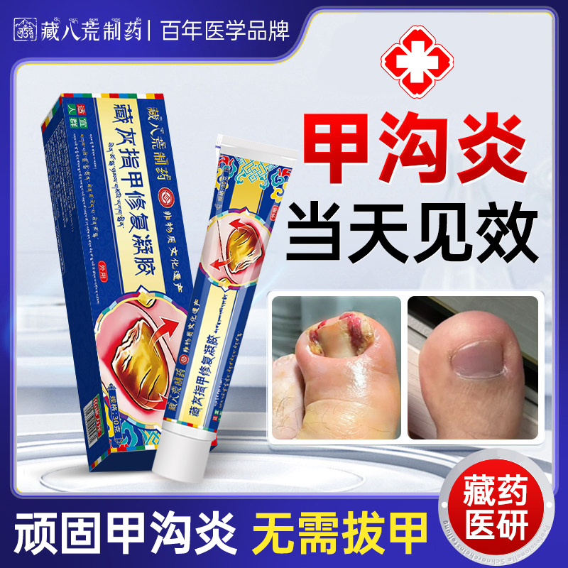 The Number One Effective Medicine for Treating Paronychia, the Special Medicine for Treating Black Nails, the Medicine Specifically for Toenails Growing into the Flesh, the Special Medicine for Softening Big Toe Nail Groove Inflammation The Number One Effective Medicine for Treating Paronychia, the Special Medicine for Treating Black Nails, the Medicine Specifically for Toenails Growing into the Flesh, the Special Medicine for Softening Big Toe Nail Groove Inflammation