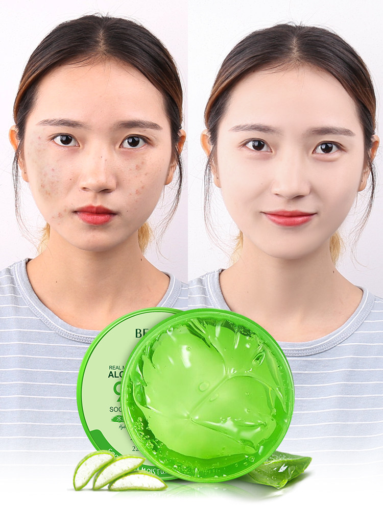 Aloe Vera Glue Water Moisturizing Shrink Hair Hole Acne Black Head Face Cream Male And Female Student Face Mask Special Thailand 