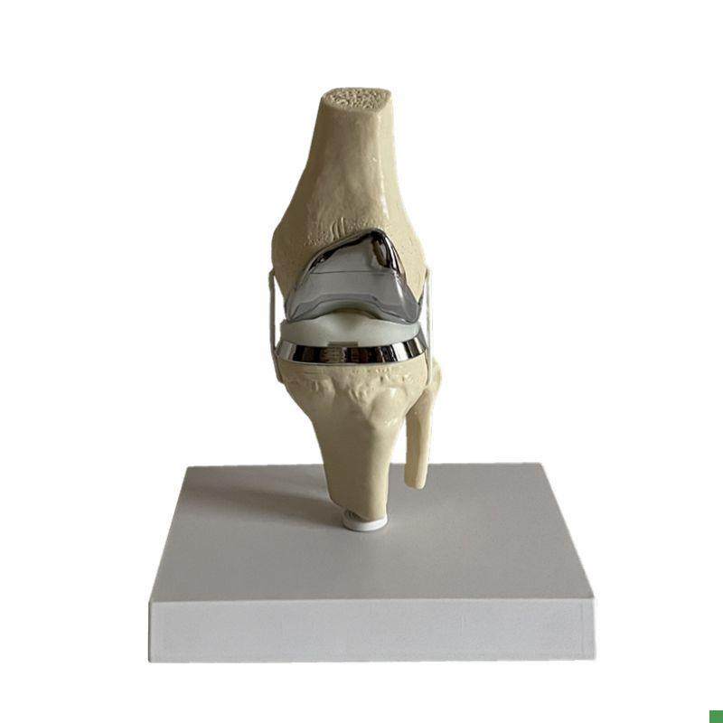 Knee Joint Artificial Prosthetic Model Meniscus Cartilage Surgery Demonstration Single-Joint Total Knee Replacement Demonstration Medical