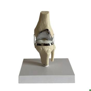 Knee Joint Artificial Prosthetic Model Meniscus Cartilage Surgery Demonstration Single-Joint Total Knee Replacement Demonstration Medical