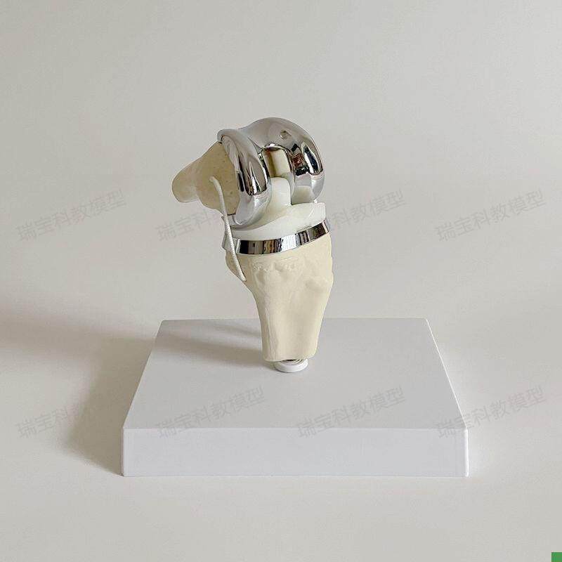 Knee Joint Artificial Prosthetic Model Meniscus Cartilage Surgery Demonstration Single-Joint Total Knee Replacement Demonstration Medical