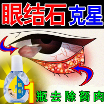 Eye stones presbyopia eye drops to remove the eye pterygium in the wind tears red blood streak repair eye liquid anti-fatigue