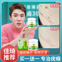 Wart wart remedies meat grains a touch of worry-free skin monkey cream pimples to remove the long neck to remove antibacterial plaster ointment