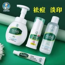 Manxiu Leitun acne skin care product set Le Skin clean anti-acne men and women to acne India oil control student acne stickers