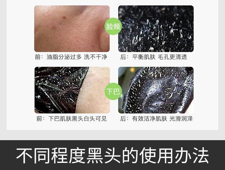 Mặt nạ than tre xé bùn bùn để mụn đầu trắng mụn trứng cá mặt đầy đủ dầu trị mụn nam nữ bán buôn đích thực viên uống trắng da collagen