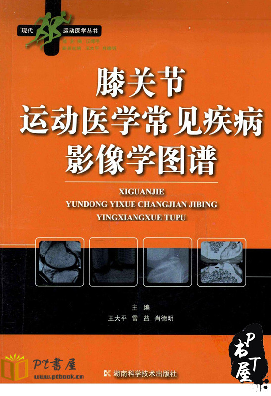 膝关节运动医学常见疾病影像学图谱 Book Cover