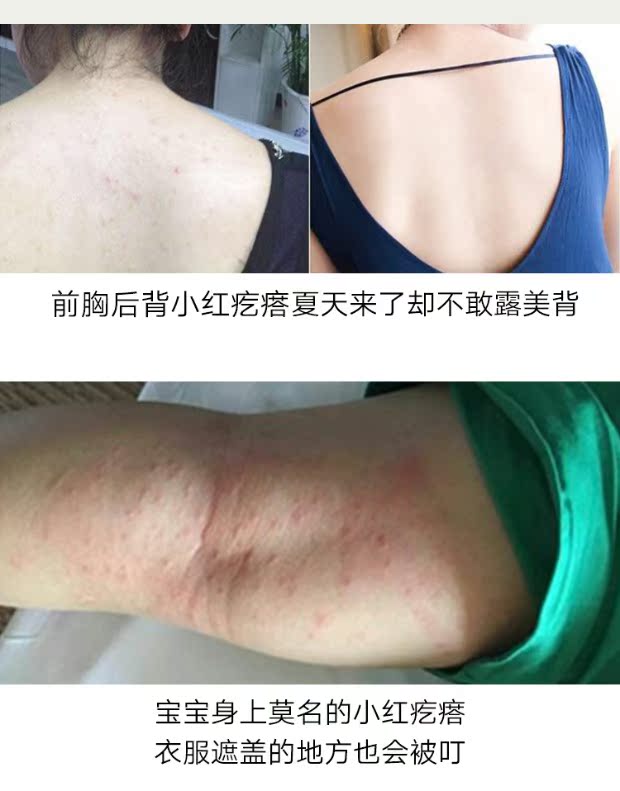 bình xịt muỗi kiến gián Man Ting Ngoài bọ ve phun bọ ve dùng một lần thuốc diệt côn trùng dùng trong gia đình không nhiễm khuẩn - Thuốc diệt côn trùng bình xịt diệt côn trùng