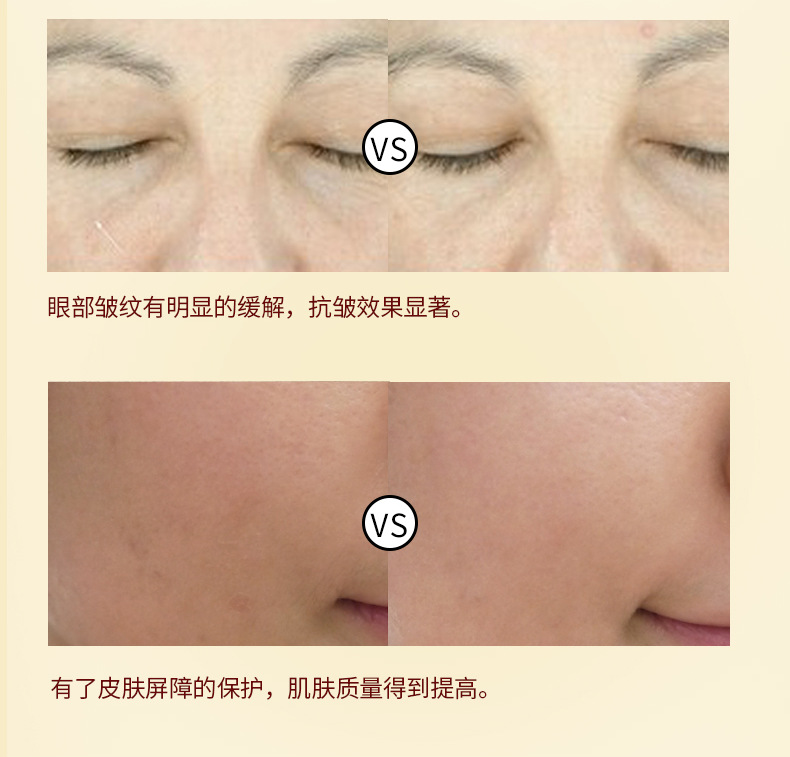 Royal House Beauty New Anti-nhăn Firming Freeze Powder Set Desalination Fine Line Dry Line Anti-Aging Essence Chính hãng - Huyết thanh mặt tinh chất bơ skinaz
