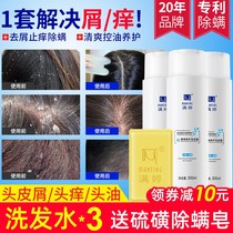 Manting mite deodorant shampoo family hoarding men and women mites dandruff control oil shampoo official