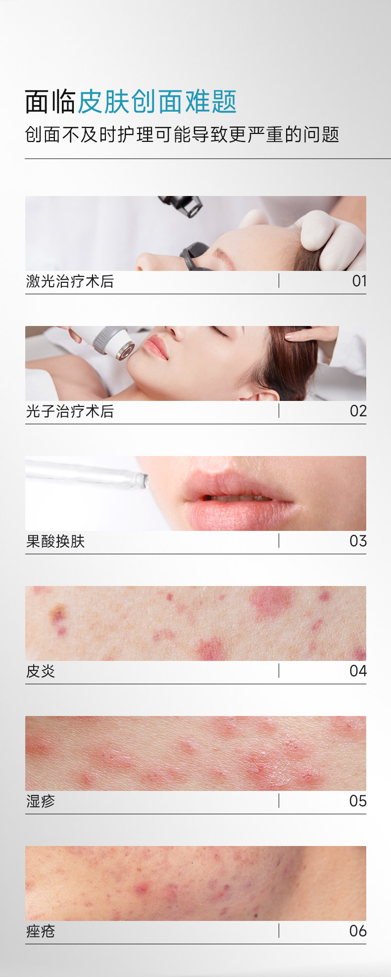 可复美 医用修复护理多糖次抛精华 1.2mL*7支 天猫优惠券折后￥39.9包邮（￥49.9-10）88VIP会员还可95折