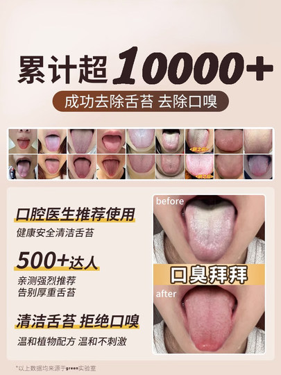 Zungenreiniger, Zungenreinigungsgel-Creme für Männer und Frauen, zur Entfernung von Mundgeruch und Mundgeruch, Reinigung und Pflege