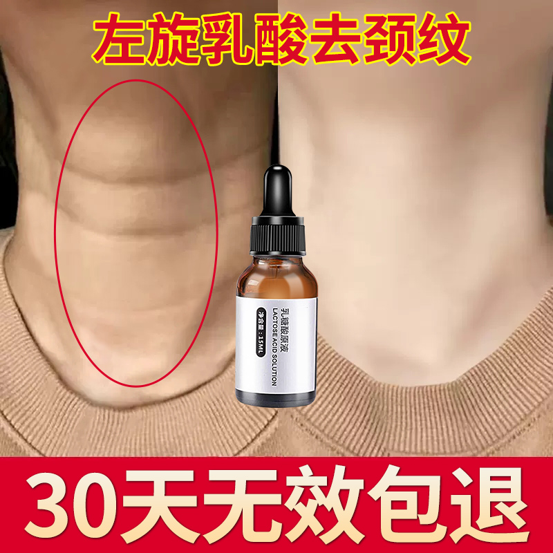 L-lactic acid de-necking stripe lifting tightening fading anti-wrinkle artifact neck care lacconic acid official