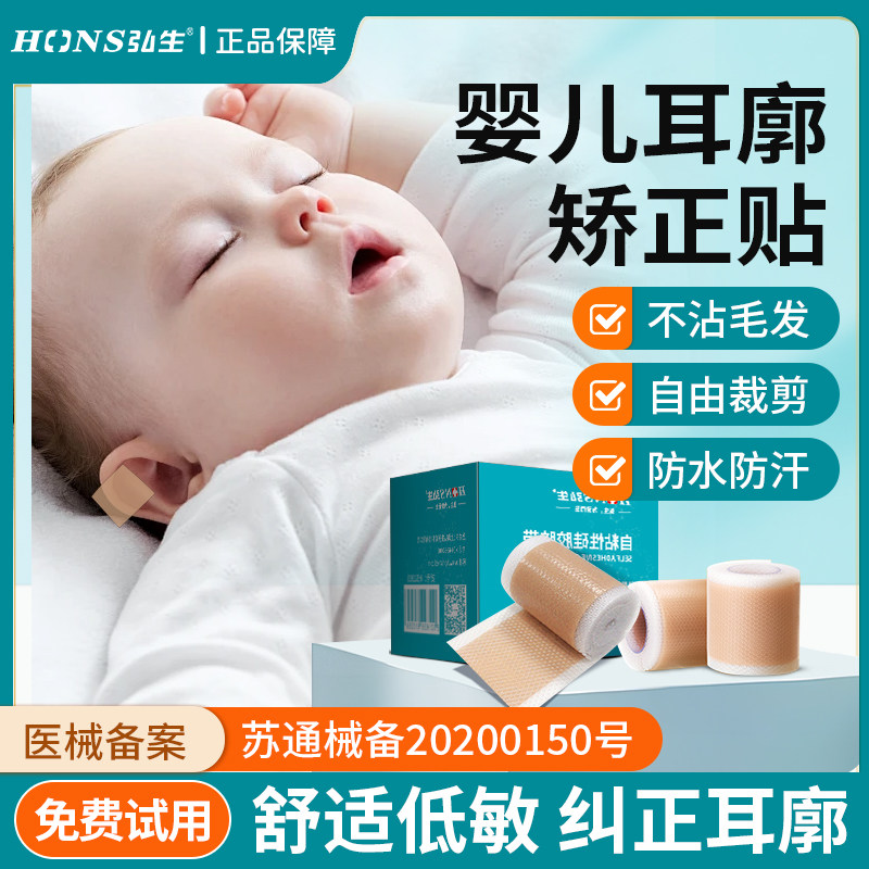 婴儿耳朵矫正贴耳廓定型医用硅凝胶胶带自粘硅胶胶布招风耳矫正器