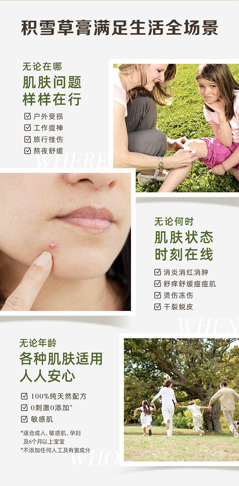 美国进口 伯特小蜜蜂 紫草膏 舒痒消包缓痛提神 8.5g 图6