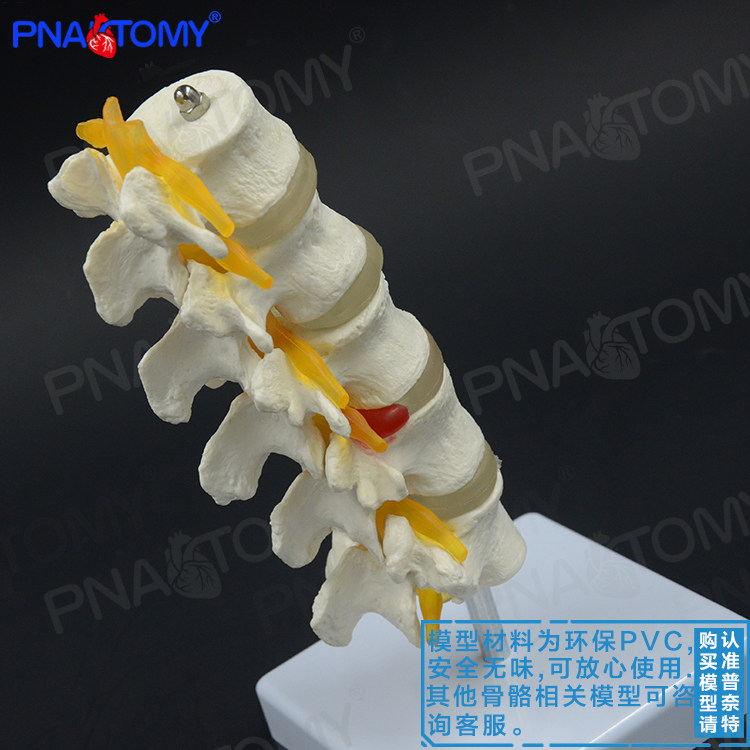 1：1医用人体腰椎脊柱脊椎模型椎间盘脊神经骨骼骨架骨科疼痛科