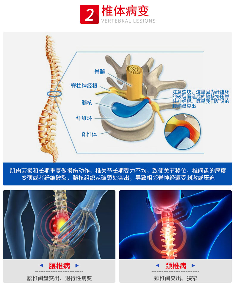 美国 PipingRock 三倍氨糖软骨素 300粒/瓶 修复关节问题 图4
