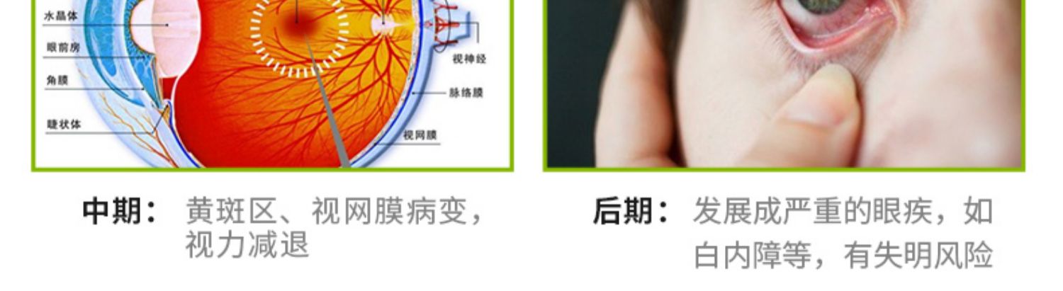 Viên nang flavonoid Mỹ 40mg90 viên thanh thiếu niên chăm sóc mắt bằng sáng chế sản phẩm chăm sóc sức khỏe sản phẩm thuốc không phải quả việt quất - Thức ăn bổ sung dinh dưỡng viên uống vitamin tổng hợp