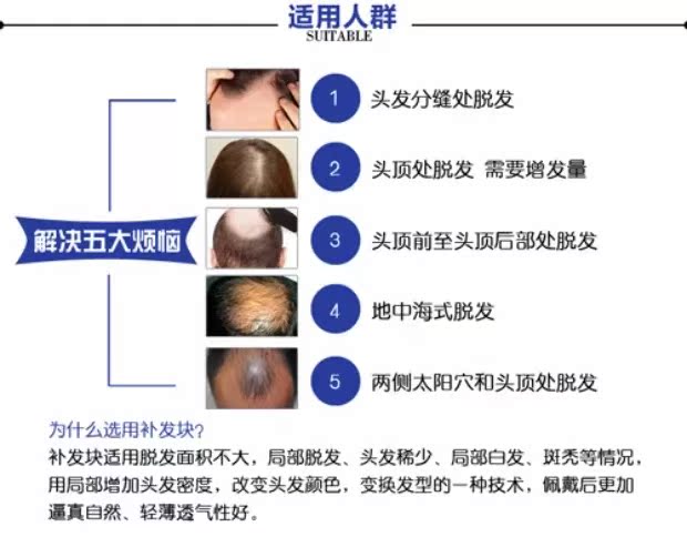 Extension cheveux - Ref 216839 Image 25