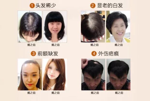 Extension cheveux - Ref 218860 Image 17