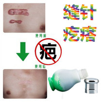 除手术抓伤疙瘩儿童剖宫产凹凸疤修复液缝针后碰伤疤痕印摔伤乳膏