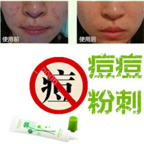Acne removal for teenagers acne scars acne scar removal acne scar removal on the chest and back thorns on the chest and back fat particles soothing and smoothing of acne