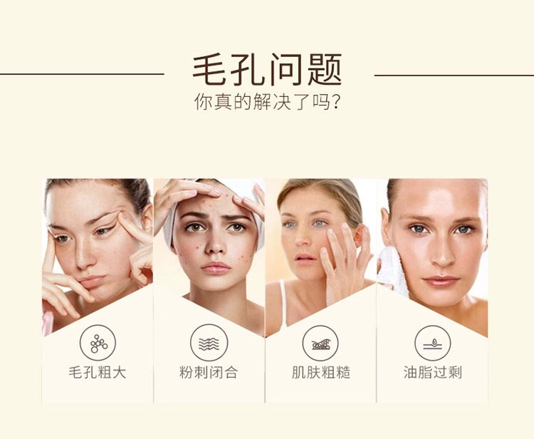 Chào Tuấn Fruity Volcanic Mud Deep Cleansing Smearing Mousse Mask Oil Kiểm soát mụn đầu đen, loại bỏ mụn và se nhỏ lỗ chân lông - Mặt nạ