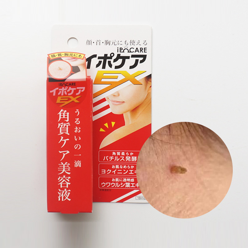 Japan Direct mail to dispel facial neck neck axillary monkey Filamentous Flesh liquid skin small meats Goose Bumps