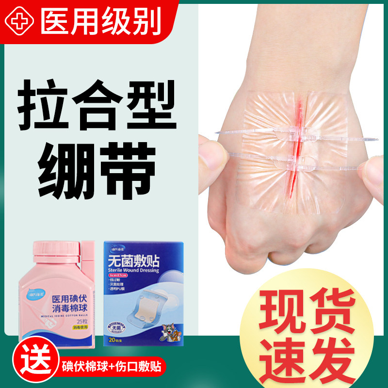 医用拉链创口贴皮肤缝合器减张贴儿童面部疤痕非免缝合伤口愈合贴