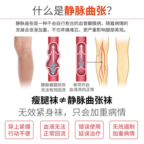 Медицинское варикозное варикозное вариковое эластичное носки медицинские брюки 祙 Женщины мужские анти -тромбозы медицинские носки ноги